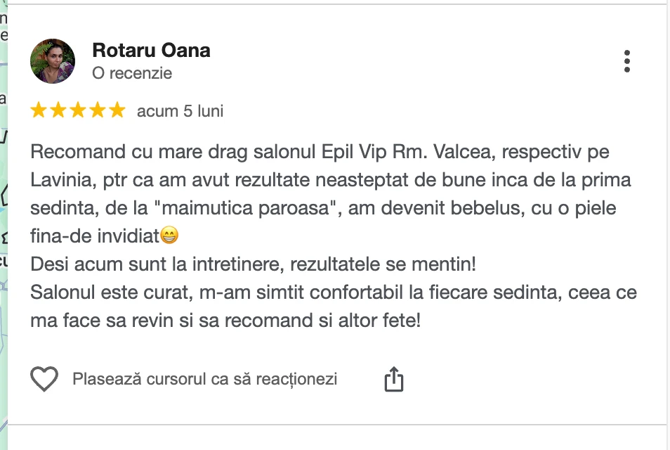 Recenzie clientă Epil VIP