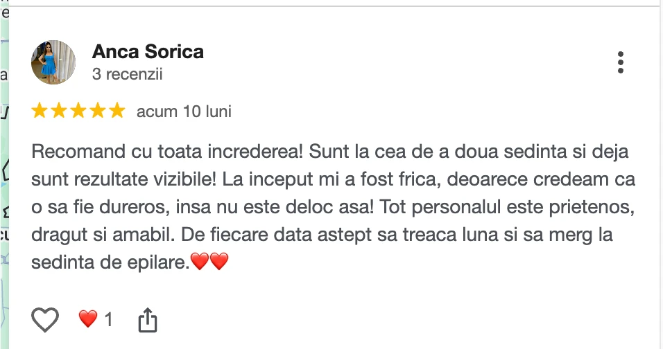 Recenzie clientă Epil VIP