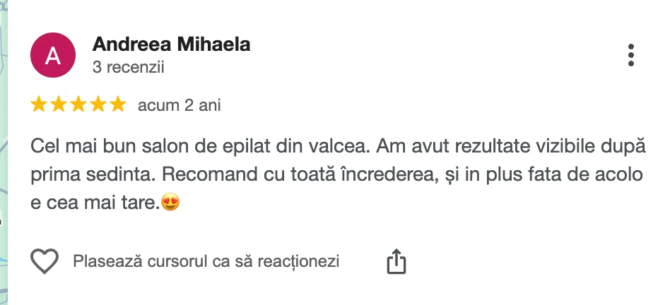 Recenzie clientă Epil VIP