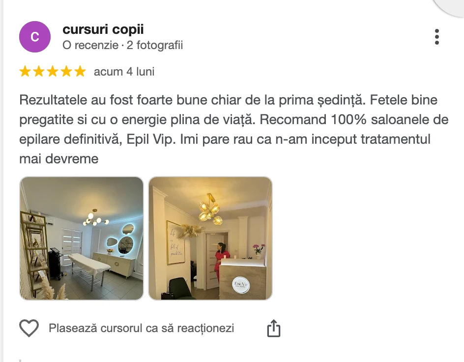 Recenzie clientă Epil VIP